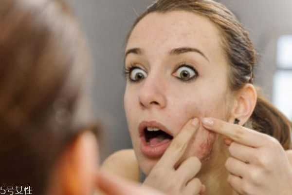 使用水杨酸为什么会爆痘