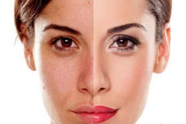 传明酸精华白天能用吗