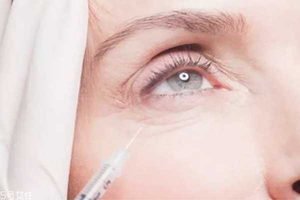 去鱼尾纹的最好土方法