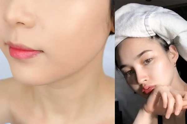 毛孔粗大什么原因引起的