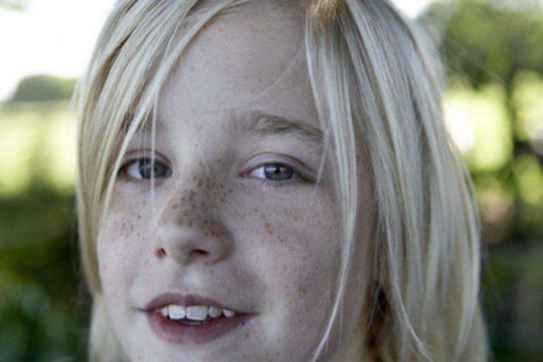 斑的种类有什么？斑是怎么形成的