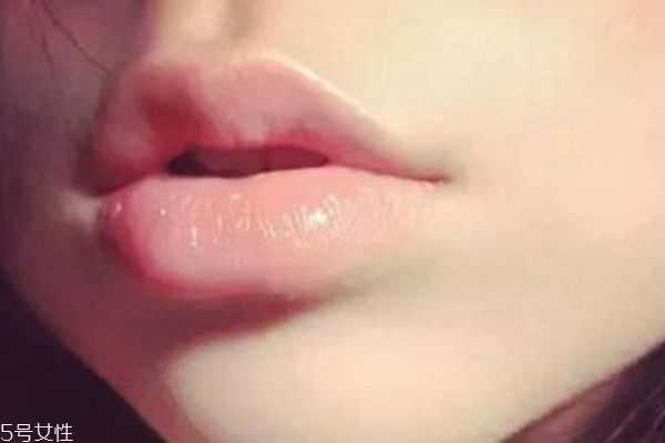 冬天嘴唇起皮怎么办