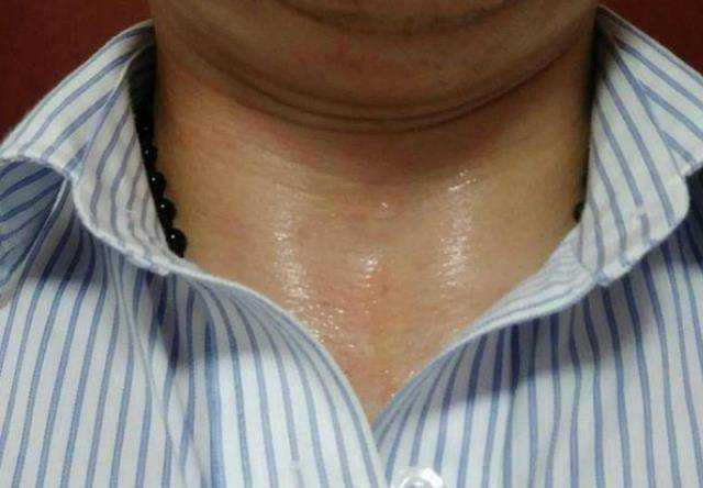 出汗能给人体带来哪些好处？ 