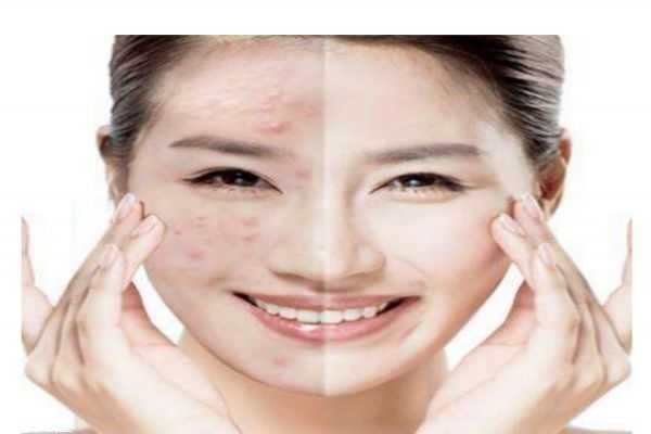 为什么脸上会长硬的包呢