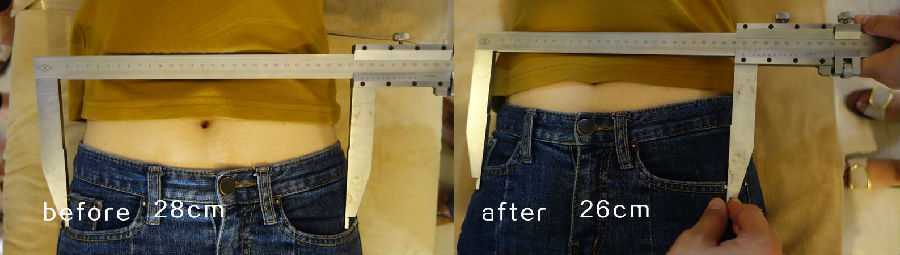 日式整骨有效果吗?效果对比图 日式整骨有效果吗?效果对比图