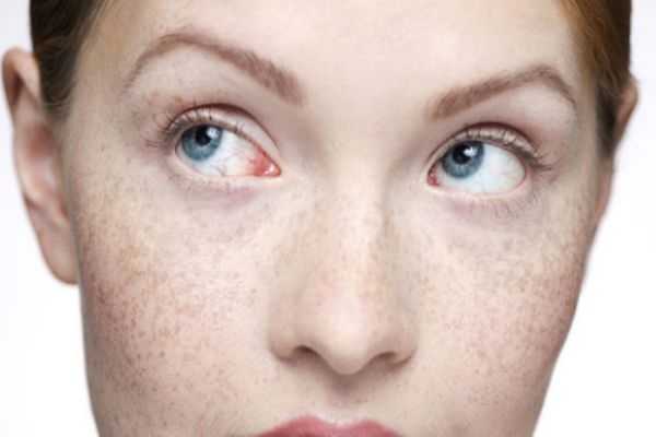 脸上有斑点用什么遮瑕效果好？口碑好的遮斑产品推荐