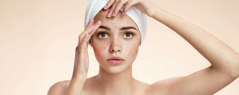 额头上的痘痘如何消除 额头上的痘痘如何消除