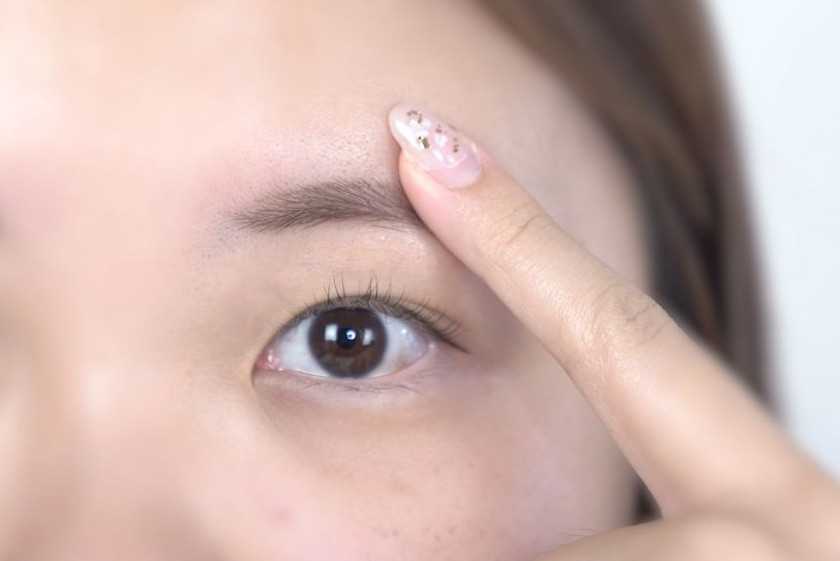 如何快速消除眼部浮肿