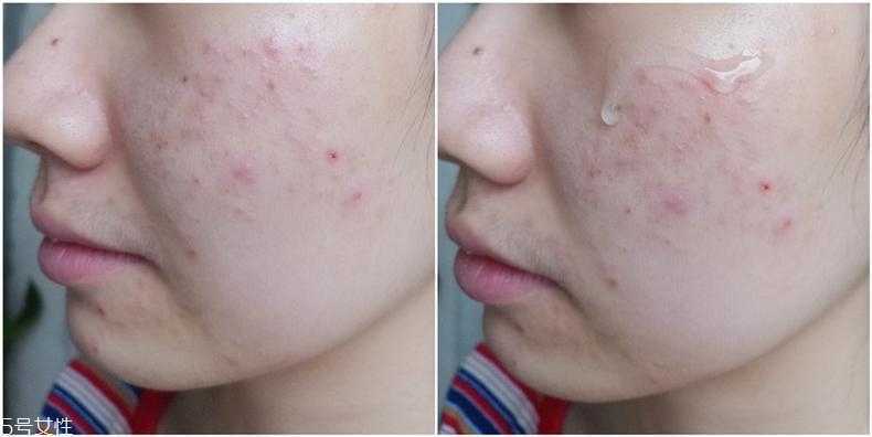 huxley仙人掌精华适合什么肤质