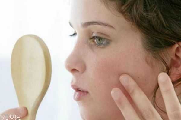 干皮为什么还长痘