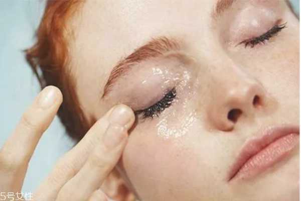 油痘皮适合的护肤品