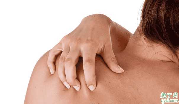 背后长痘是不是有螨虫?后背长痘痘怎么调理好 背后长痘是不是有螨虫?后背长痘痘怎么调理好