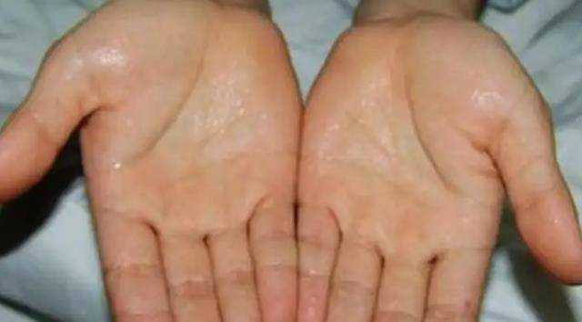 出汗能给人体带来哪些好处？ 