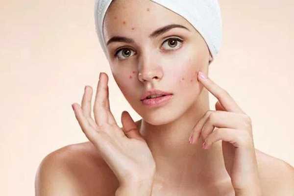 哪款隔离霜适合痘痘肌