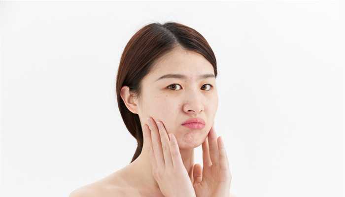 生姜擦脸可以祛痘吗 生姜擦脸可以祛痘吗