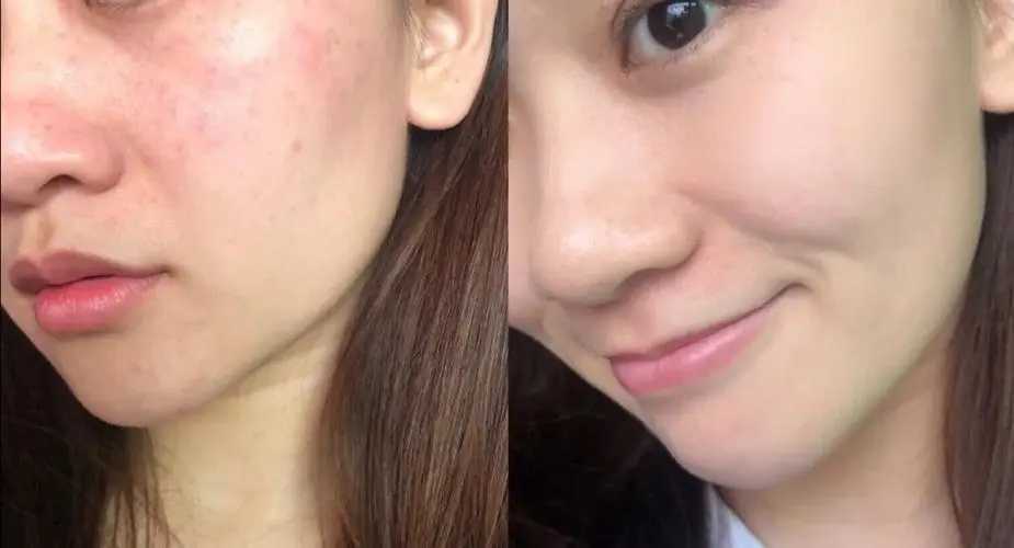 1718623017201220.jpg u=241794713,1072365614&fm=253&fmt=auto&app=138&f=JPEG.webp.jpg