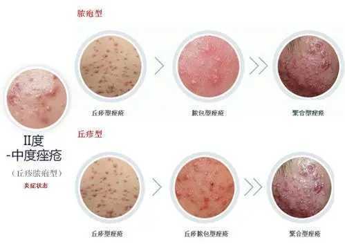 1718676964374406.jpg u=3817191492,284137946&fm=253&fmt=auto&app=138&f=JPEG.webp.jpg