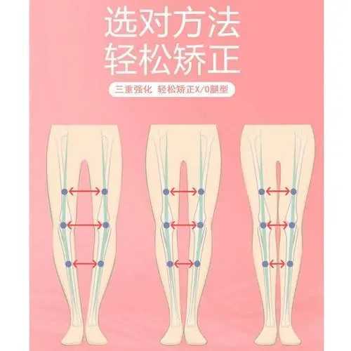 x型腿怎么矫正 x型腿怎么矫正