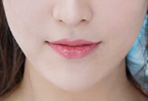 日式整骨小颜术价格 日式整骨小颜术价格