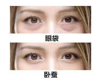 卧蚕是什么?它和眼袋有什么区别 卧蚕是什么?它和眼袋有什么区别
