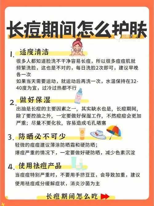 学生祛痘小妙招都有哪些 学生祛痘小妙招都有哪些