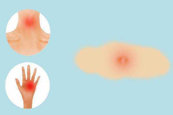 皮肤上米粒大小的疙瘩是什么东西？