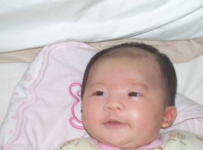 夏天宝宝长痱子怎么办 夏天宝宝长痱子怎么办