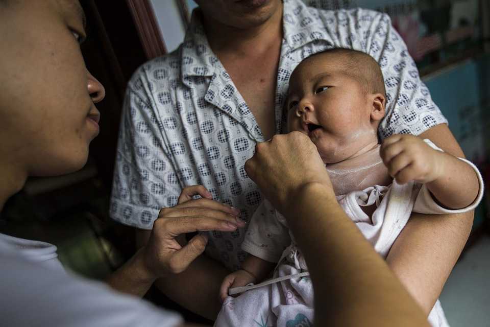 夏天宝宝长痱子怎么办 夏天宝宝长痱子怎么办