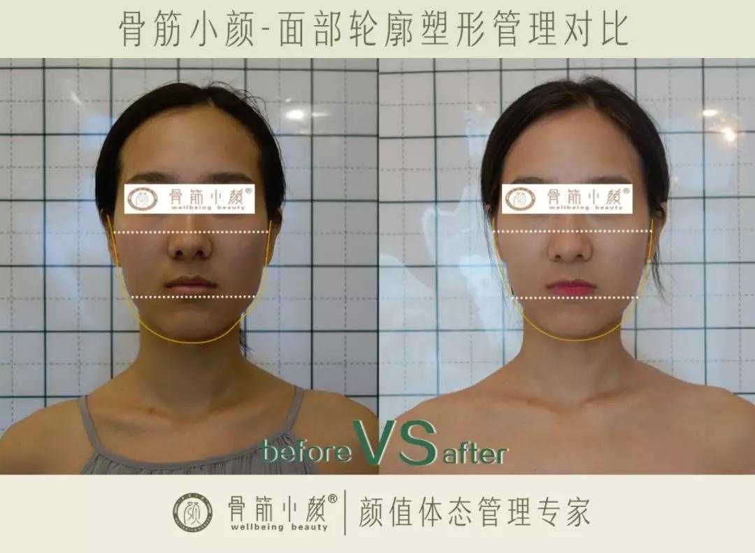 日式整骨小颜都有哪些管理项目 日式整骨小颜都有哪些管理项目