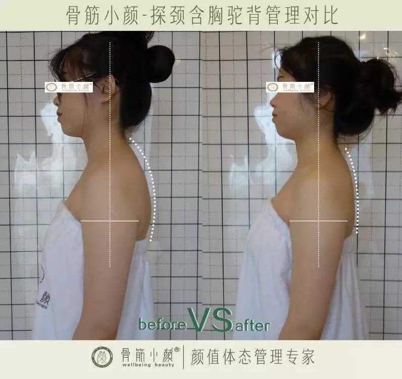 日式整骨小颜都有哪些管理项目 日式整骨小颜都有哪些管理项目