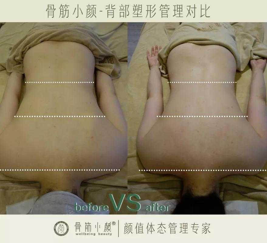 日式整骨小颜都有哪些管理项目 日式整骨小颜都有哪些管理项目