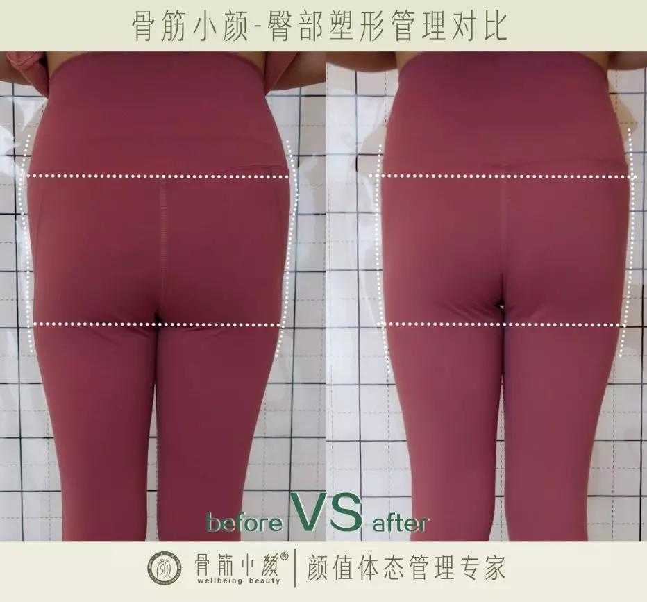 日式整骨小颜都有哪些管理项目 日式整骨小颜都有哪些管理项目