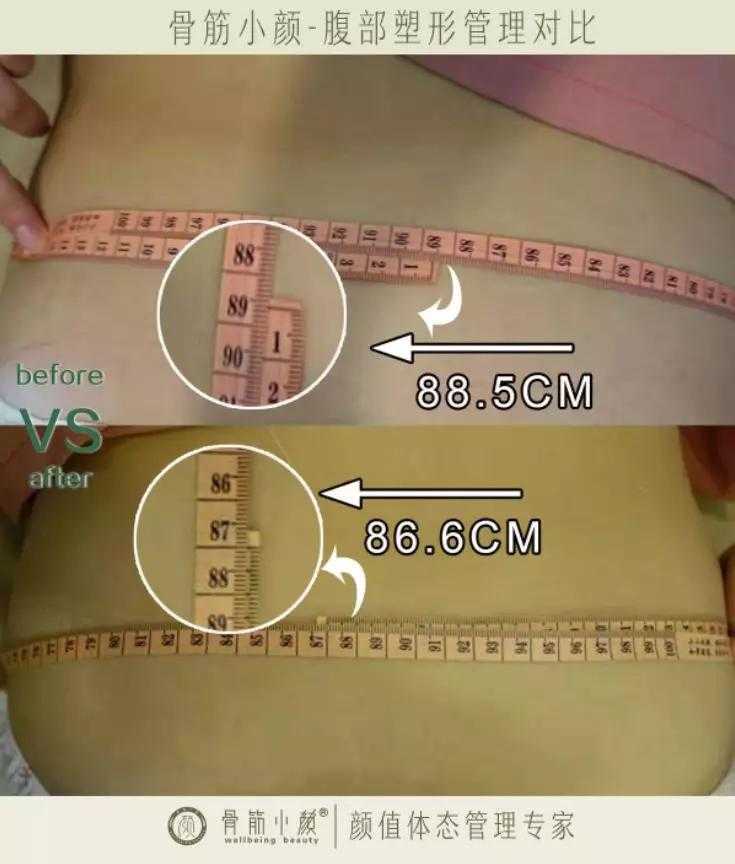 日式整骨小颜都有哪些管理项目 日式整骨小颜都有哪些管理项目