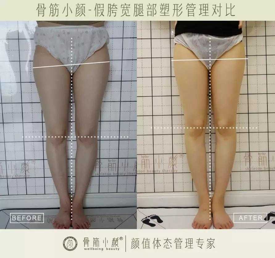 日式整骨小颜都有哪些管理项目 日式整骨小颜都有哪些管理项目