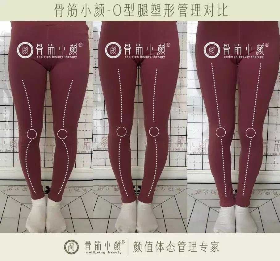 日式整骨小颜都有哪些管理项目 日式整骨小颜都有哪些管理项目