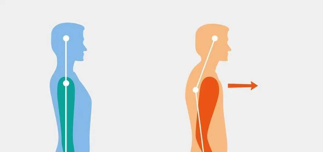 50岁治驼背最有效的方法 50岁治驼背最有效的方法