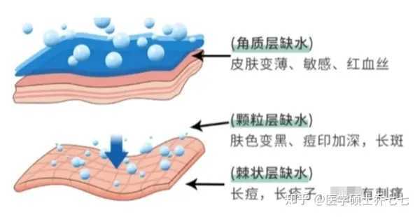 新手自己刷酸的正确方法步骤