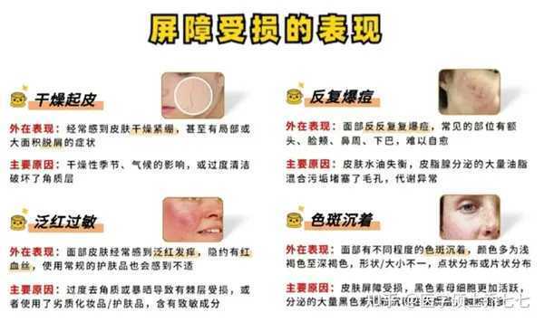 新手自己刷酸的正确方法步骤