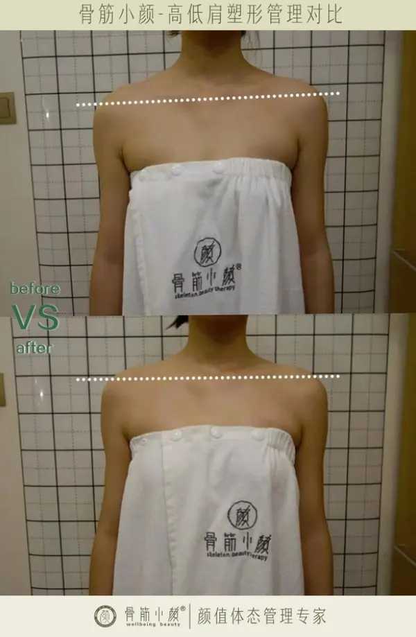 骨筋小颜日式整骨 (2).jpg