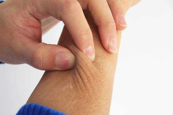 为何女人的皮肤老得快？