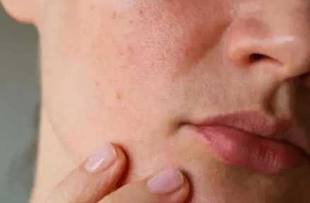 护肤品不耐受是产品的问题吗