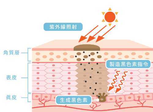 为什么会长斑?斑是怎么形成的? 为什么会长斑?斑是怎么形成的?