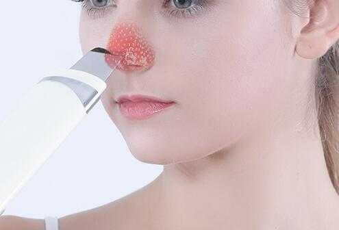 脸上为什么会长黑头？粉刺形成的原因