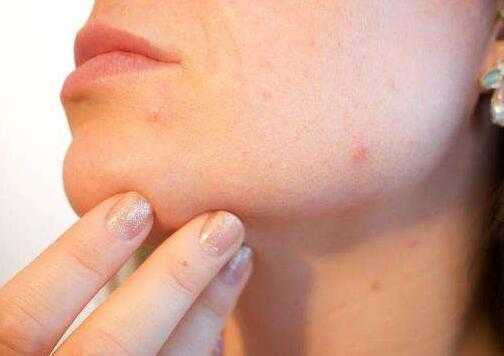 皮肤粗糙毛孔大怎么办?皮肤粗糙毛孔粗大原因 皮肤粗糙毛孔大怎么办?皮肤粗糙毛孔粗大原因