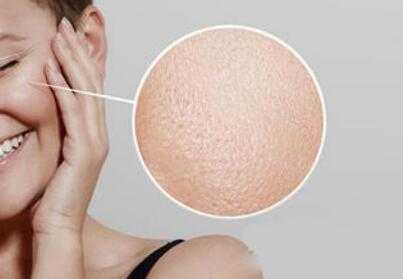 皮肤粗糙毛孔大怎么办?皮肤粗糙毛孔粗大原因 皮肤粗糙毛孔大怎么办?皮肤粗糙毛孔粗大原因