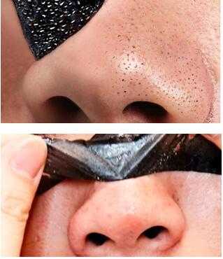 鼻子上很多黑头怎么办 草莓鼻去黑点方法