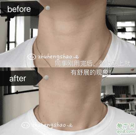 米加颈霜有没有效果