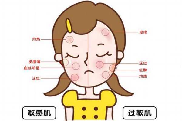 敏感肌肤怎么修复好