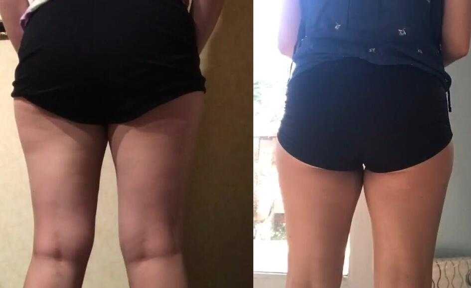 女生深蹲一个月效果图对比