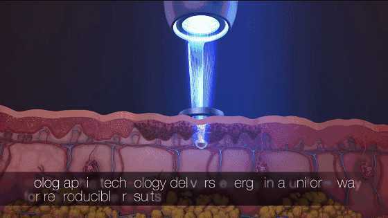 骨筋小颜教你溜肩怎么改善 骨筋小颜教你溜肩怎么改善